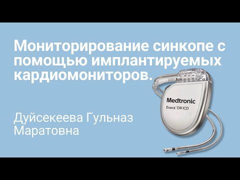 Длительное мониторирование синкопе с помощью имплантируемых кардиомониторов. Алгоритм действия