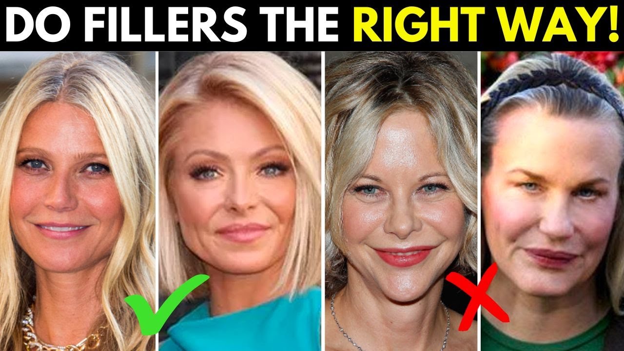 ⁣The Right and Wrong way to use fillers for anti-aging