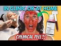 Chemical Peels: 3 Surprising Things That Happen When You Get Chemical Peels