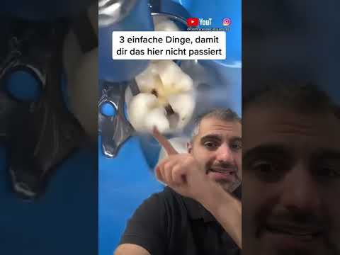 Karies ganz einfach