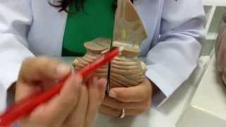 Tronco encefálico - parte 4: Mesencéfalo