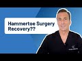 Hammer Toe Surgery: How Long Is The Recovery?