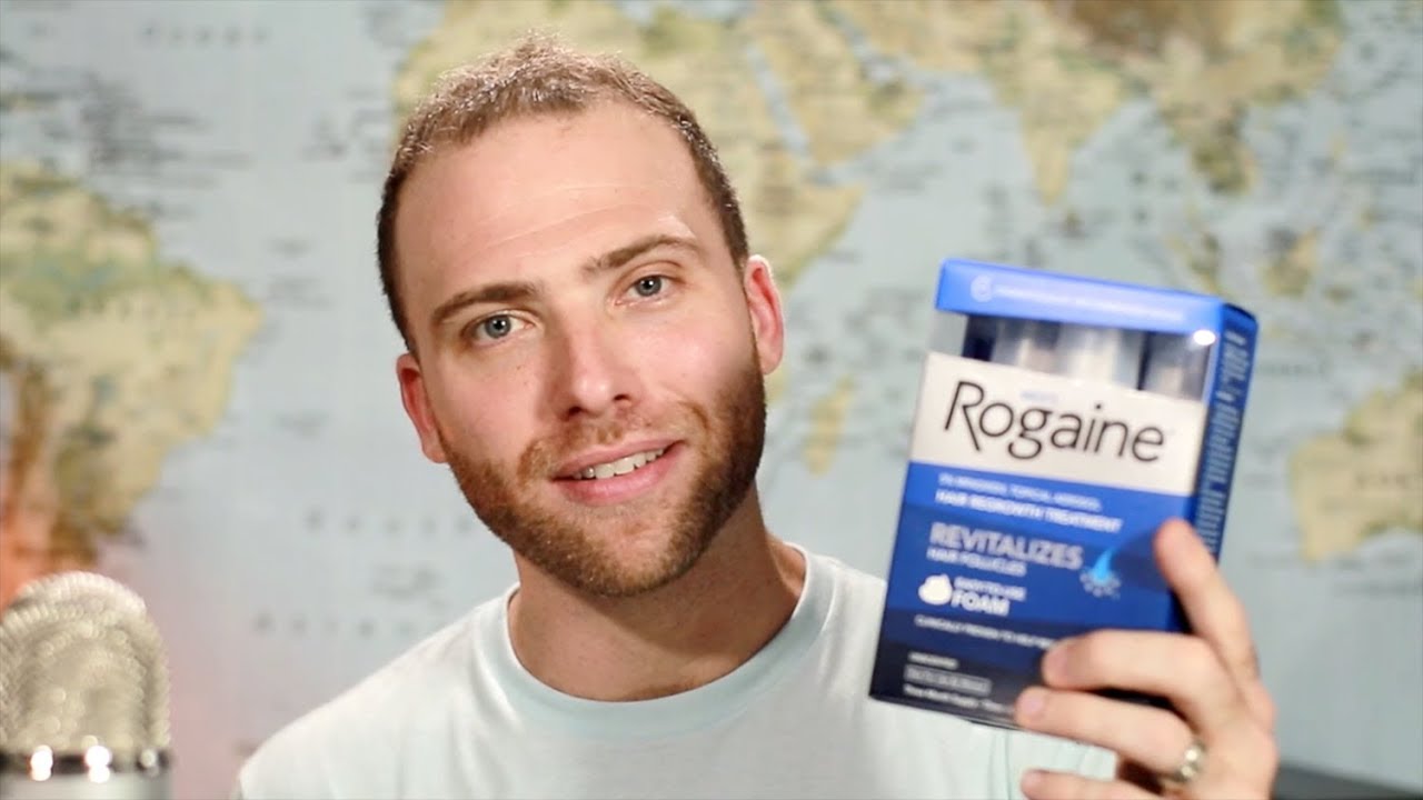 Rogaine REALLY WORKS! 9 Month RESULTS | MENS ROGAINE JOURNEY - YouTube