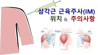 삼각근의 IM(근육주사) - 위치, 주의사항을 함께 보시죠. (삼각근의 근육주사 요약 2.)