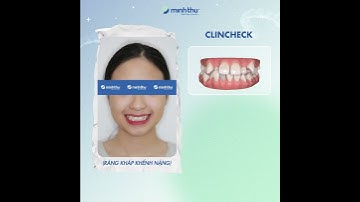 𝐑Ă𝐍𝐆 𝐊𝐇Ấ𝐏 𝐊𝐇Ể𝐍𝐇 𝐍Ặ𝐍𝐆 - 𝐌Ấ𝐓 𝐁𝐀𝐎 𝐋Â𝐔 ĐỂ 𝐍𝐈Ề𝐍𝐆?