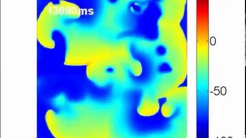 Electrophysiological Rotor Ablation in In-Silico Modeling of Atrial Fibrillation: Comparisons