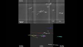 Cancer cells migrating toward a 