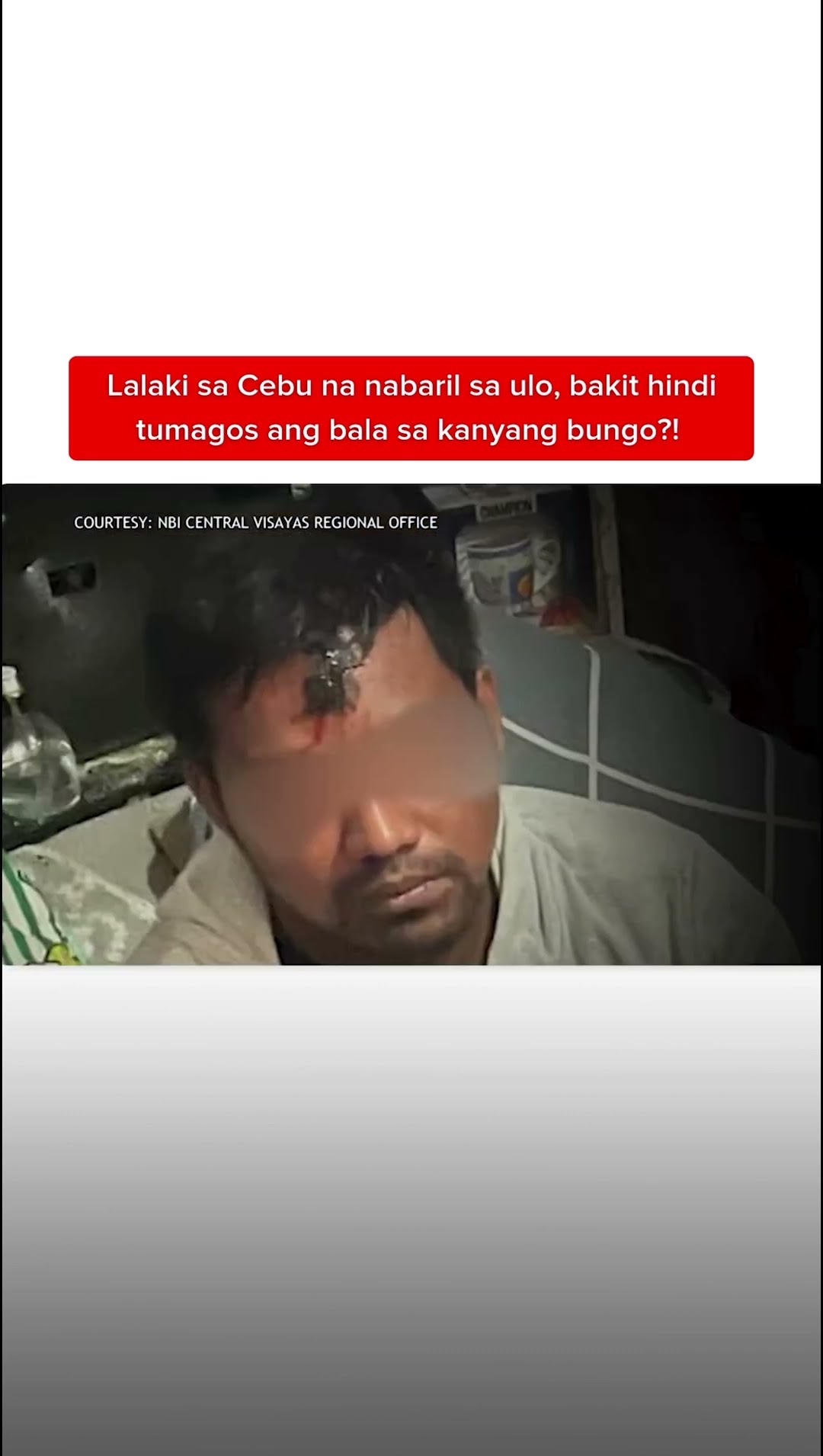 Lalaking nabaril sa ulo, bakit hindi tumagos ang bala sa kanyang bungo?! | Kapuso Mo, Jessica Soho