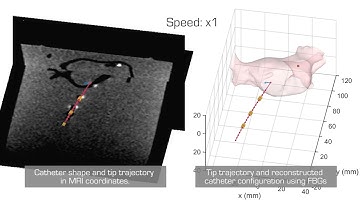 Shape Tracking and Feedback Control of Cardiac Catheter Using MRI-guided Robotic Platform