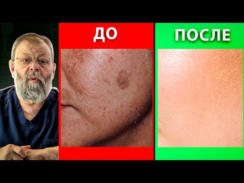 Video: Sú bronzery na pokožku bezpečné?