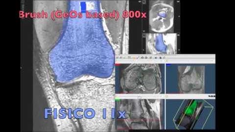 FISICO: Fast Image SegmentatIon COrrection