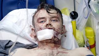 His Son St*bbed Him! Worst Injuries From Ambulance: Code Red Back-To-Back Episodes