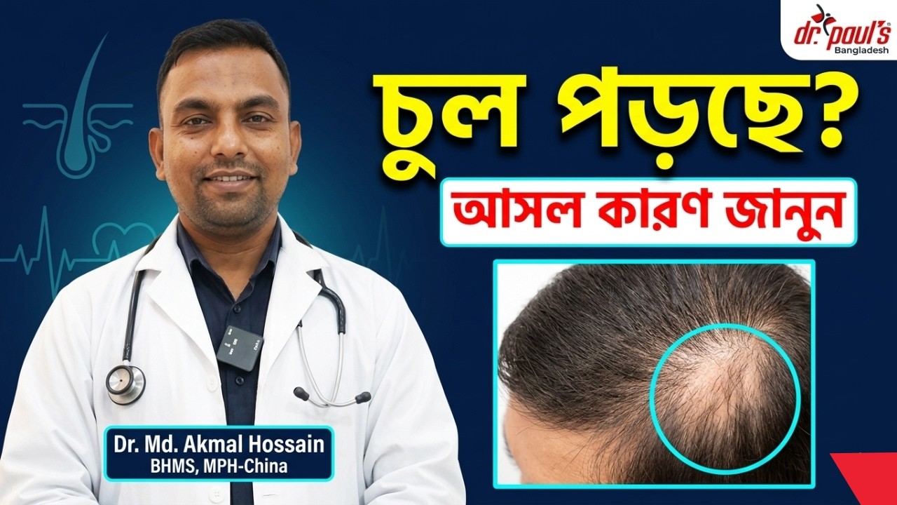 মাথায় চাকা চাকা টাক বা এলোপেসিয়া এরিয়াটা কেন হয়? | Alopecia Areata ...