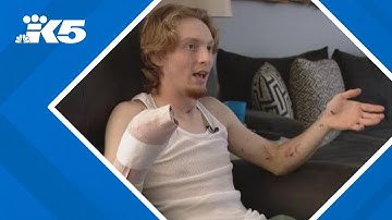 Washington teen loses hand in fireworks accident while protecting young kids