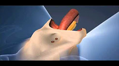 mtf transgendered is all woman now hung shemale thumbs