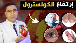 أعراض ارتفاع الكوليسترول والدهون الثلاثية في الدم | النسب الطبيعية والمرتفعه للكولسترول والدهون