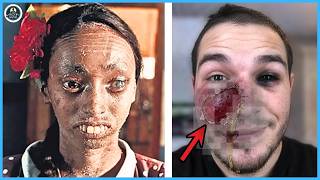 Top 20 People You Won’t Believe Exist: The Most Extreme Biological Anomalies 2026