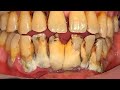 WHAT’S THIS? YOU MUST WATCH THIS! | Dentist | Dokter Gigi Tri Putra