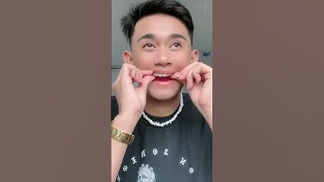 Hàm niềng răng giả?| Lạc Việt Intech Niềng Răng #shorts
