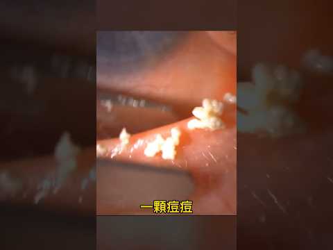 你的乾眼症一直好不了的原因竟然是