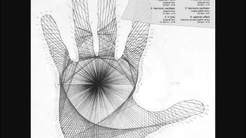 Furtherset - Zeeman Effect (Manvoy De Saint Sadrill Remix)