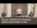 ‘Is this patriot enough?’: Asian-American veteran shows scars as he calls out anti-Asian hate