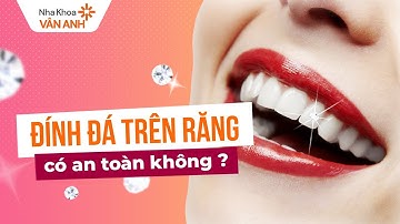 Đính đá lên răng có an toàn không?