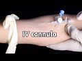    how to insert iv cannula