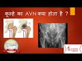 AVN ( Hindi) Hip Joint Pain