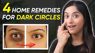 Erase DARK CIRCLES like Magic - 4 Home Remedies for Glowing Skin | By GunjanShouts