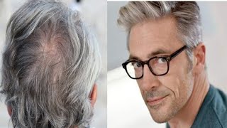 علاج الصلع والشيب طبيعيا فقط داومي عليه Treating baldness and graying  naturally