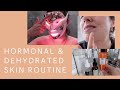 My Weekly Routine For Hormonal & Dehydrated Skin | The Anna Edit