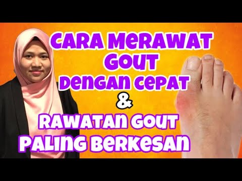 Cara Merawat Gout Dengan Cepat & Rawatan Gout Paling 