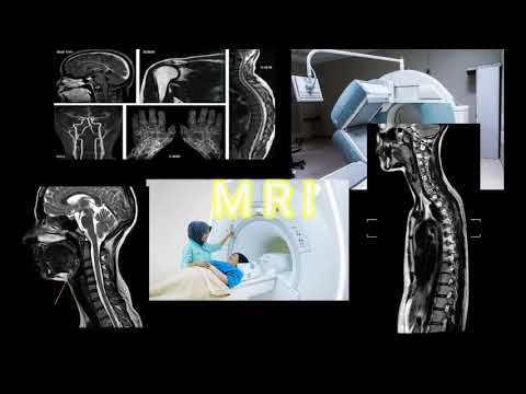 Video: MRI Dada: Tujuan, Prosedur, Dan Risiko