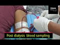 Pre and post dialysis blood sampling techniques urea reduction ratio urr part 1