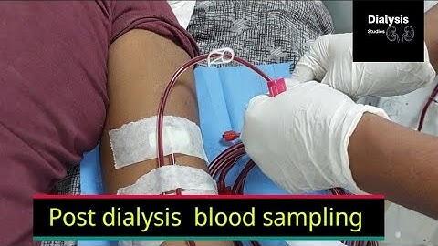 Pre and Post Dialysis Blood Sampling techniques| Urea Reduction Ratio (URR) Part -1