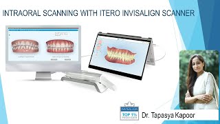 Intraoral Scanning with iTero 3D Invisalign Scanner