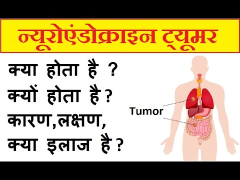 वीडियो: अंदर और बाहर ट्यूमर होने पर हम क्या करते हैं?