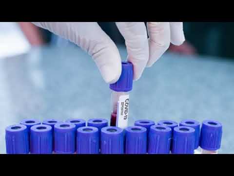 Detención Guardia Civil por PCR Falsos Noticia Informativos 27/05/2021