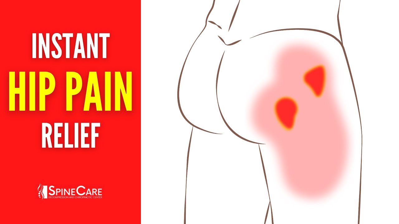 Why You Have Hip Pain—and How to Treat It