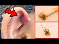 CLEAN Your Piercings Or THIS Can Happen…*REMOVAL*
