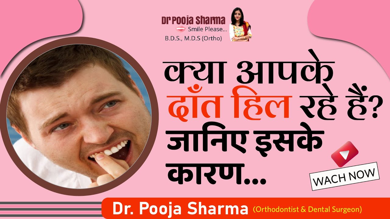 Causes of Tooth Mobility | जानिये आपके दाँत क्यू हिल रहे है? Fix Loose ...