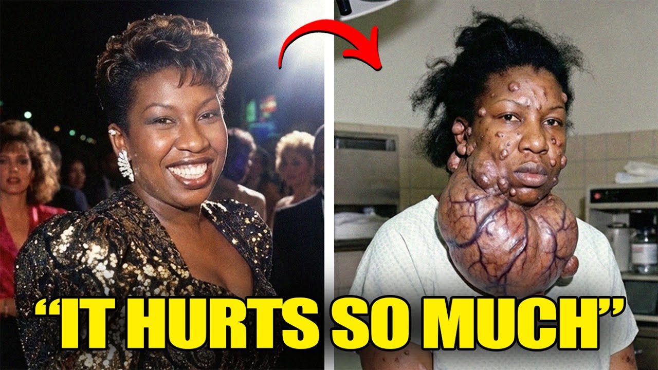 27 Black Celebrities Who Died From Incurable Diseases
