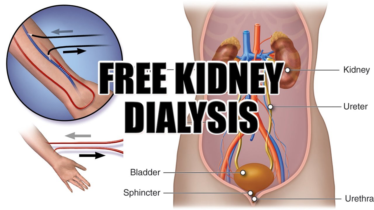 फ्री किडनी डायलिसिस Free Kidney Dialysis YouTube