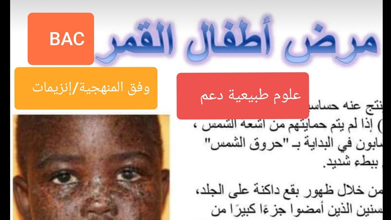 ألو أنزيمات الوحدة 3 :التحفيز الإنزيمي،  تمارين دعم وفق المنهجية