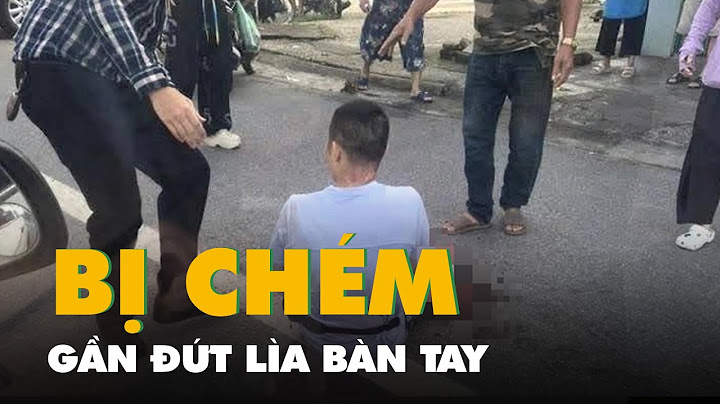 Một Tiktoker bị chém gần đứt lìa bàn tay