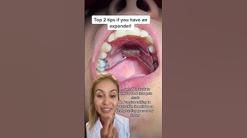 Top 2 Tips If You Have an Expander