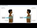Placement and Direction of the Central Ray In radiography; critical technical step