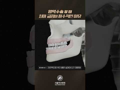 <strong>양악수술</strong>, 치아 교정이 필수인 이유