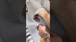 Kecoa remot kontrol barhasil bikin kakak geli #trending